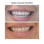 Kathy Cosmetic Dentistry