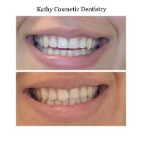 Kathy Cosmetic Dentistry ico