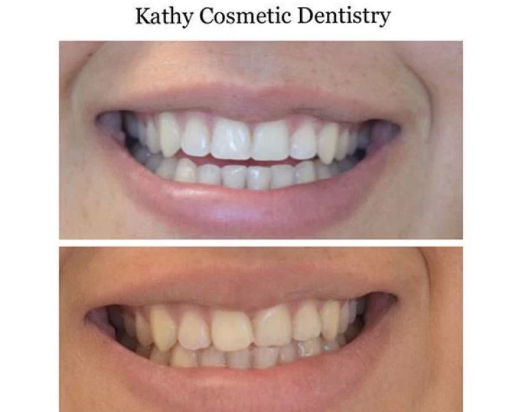 Kathy Cosmetic Dentistry