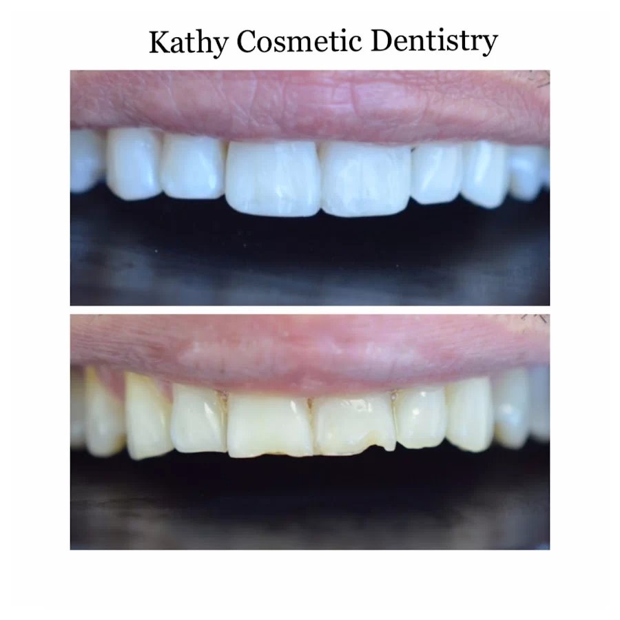 Kathy Cosmetic Dentistry 5