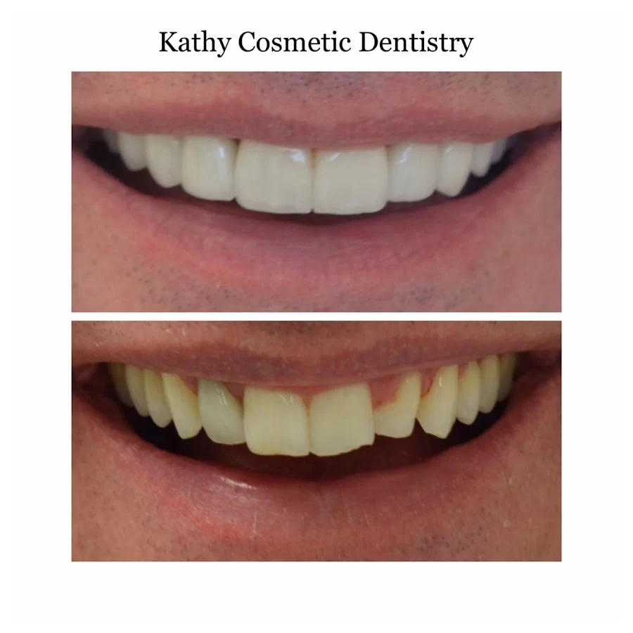 Kathy Cosmetic Dentistry 6