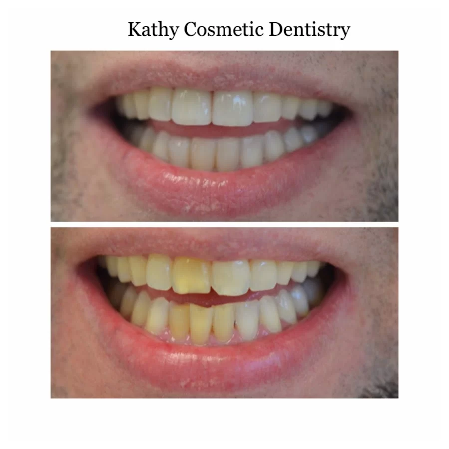 Kathy Cosmetic Dentistry 7