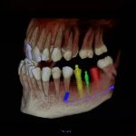 The Tender Dentist