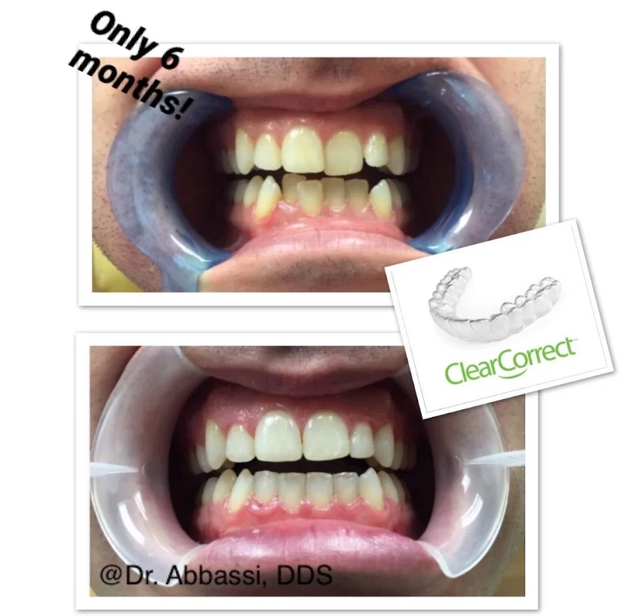 Dr. Summy Abbassi, DDS 5