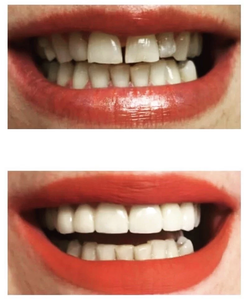 Dr. Summy Abbassi, DDS 4