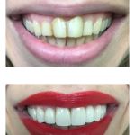 Dr. Summy Abbassi, DDS