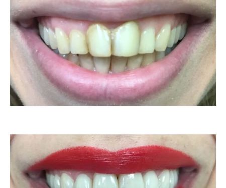 Dr. Summy Abbassi, DDS
