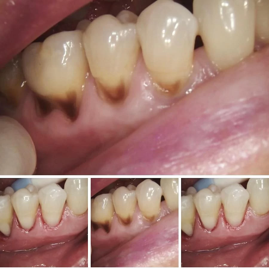 Royal Dental Practice | Dr. Roya Shoffet-Yaghoubian 8