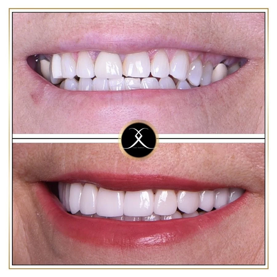 Northridge Advanced Dentistry | Northridge Dentist 4