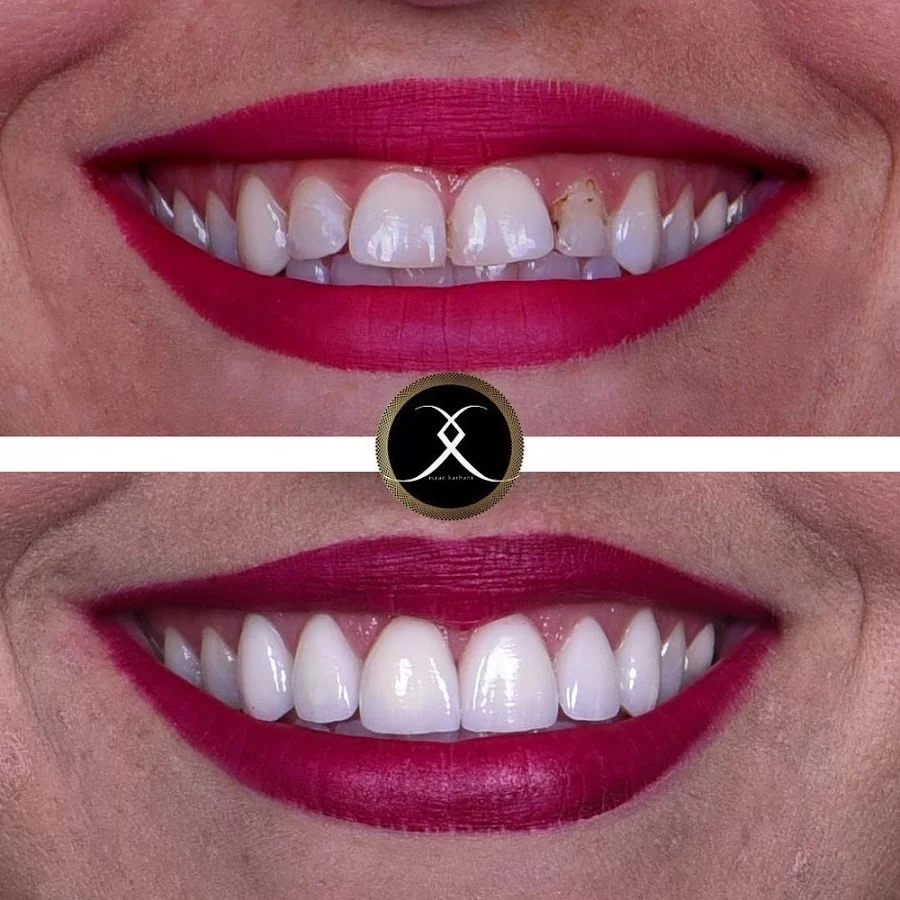 Northridge Advanced Dentistry | Northridge Dentist 7
