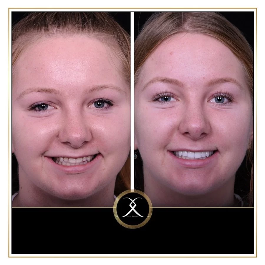 Northridge Advanced Dentistry | Northridge Dentist 3