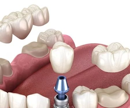 Arcadia Dental Group