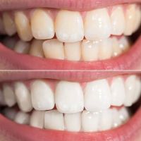 Dr. David Hakham, Dentist in Montebello ico