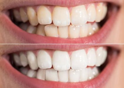 Dr. David Hakham, Dentist in Montebello