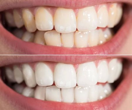 Dr. David Hakham, Dentist in Montebello
