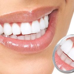 Best Dentist for Filling Cavities and Preventing Decay in Phoenix: Find Top Dental Care Near You