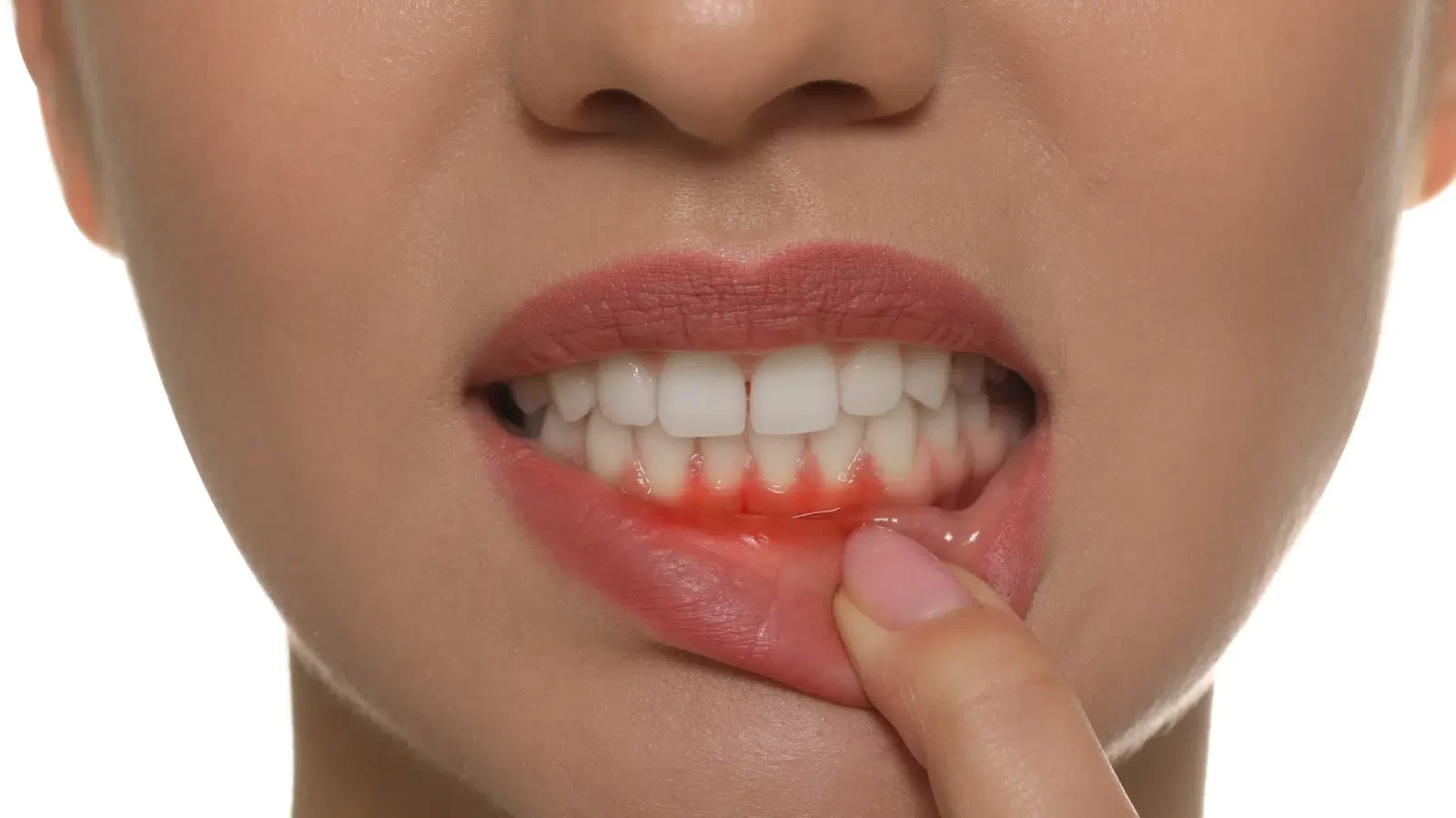 Signs of a Gum Infection and When to See a Dentist: Comprehensive Guide