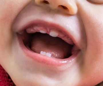 How to Address Teething Issues in Infants: Comprehensive Guide