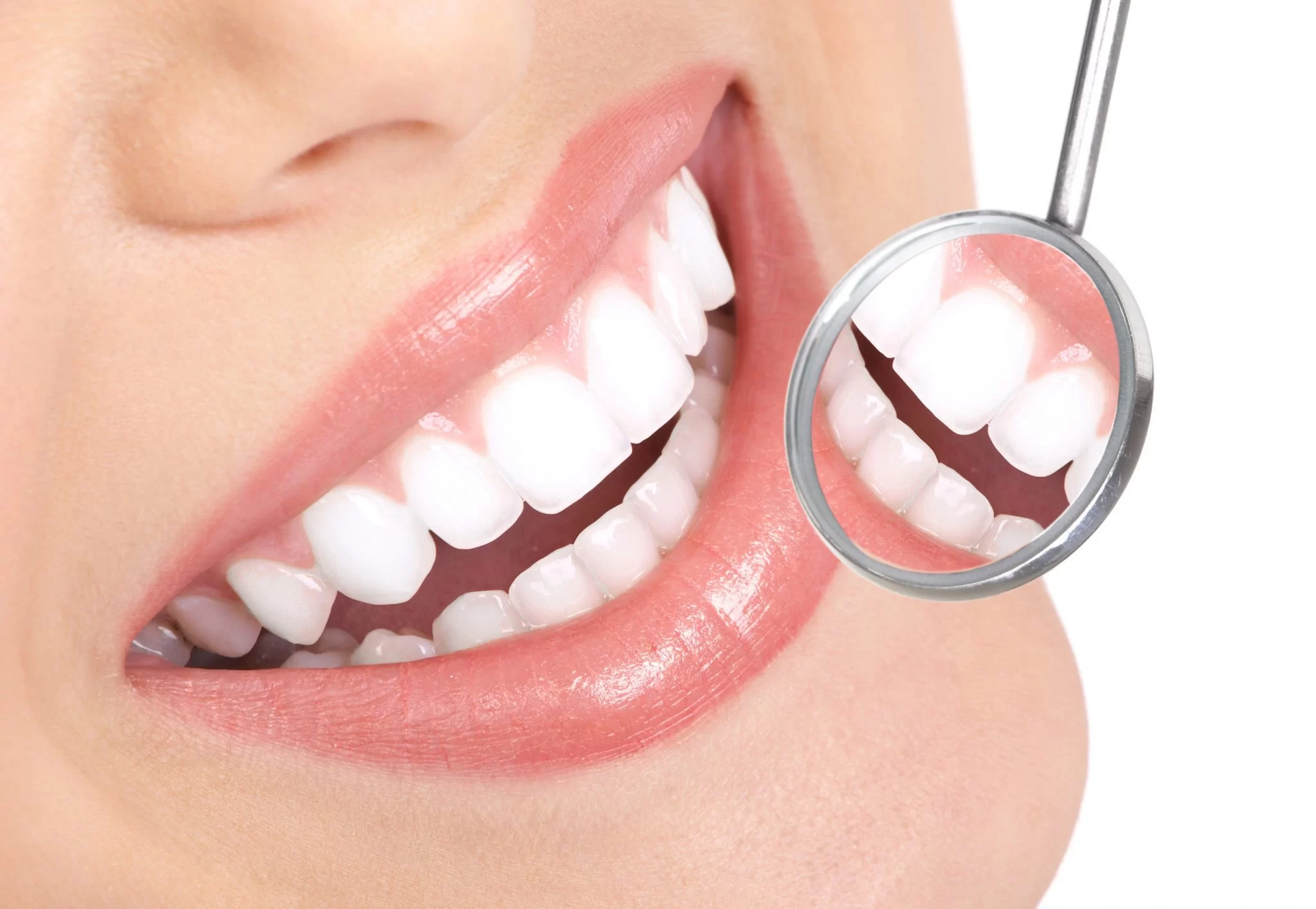 Safe Teeth Whitening Options for Sensitive Gums: Protect Your Smile