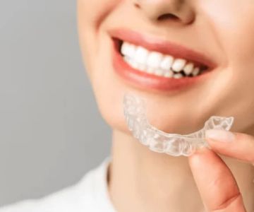 Clear Aligners for Teens and Adults: The Ultimate Guide to Straightening Teeth