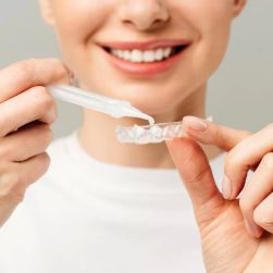 Professional Teeth Whitening vs Over-the-Counter Products: Comprehensive Comparison