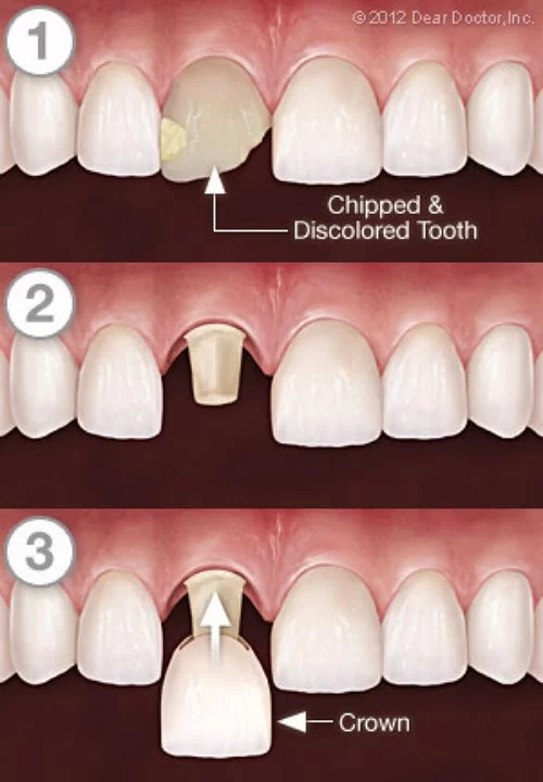 Riverdale Dental Associates Picture 6