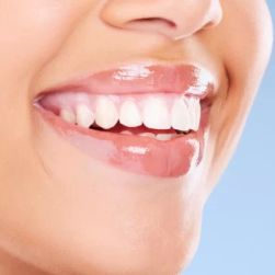 Treatment for Tooth Discoloration: Brighten Your Smile with Expert Solutions