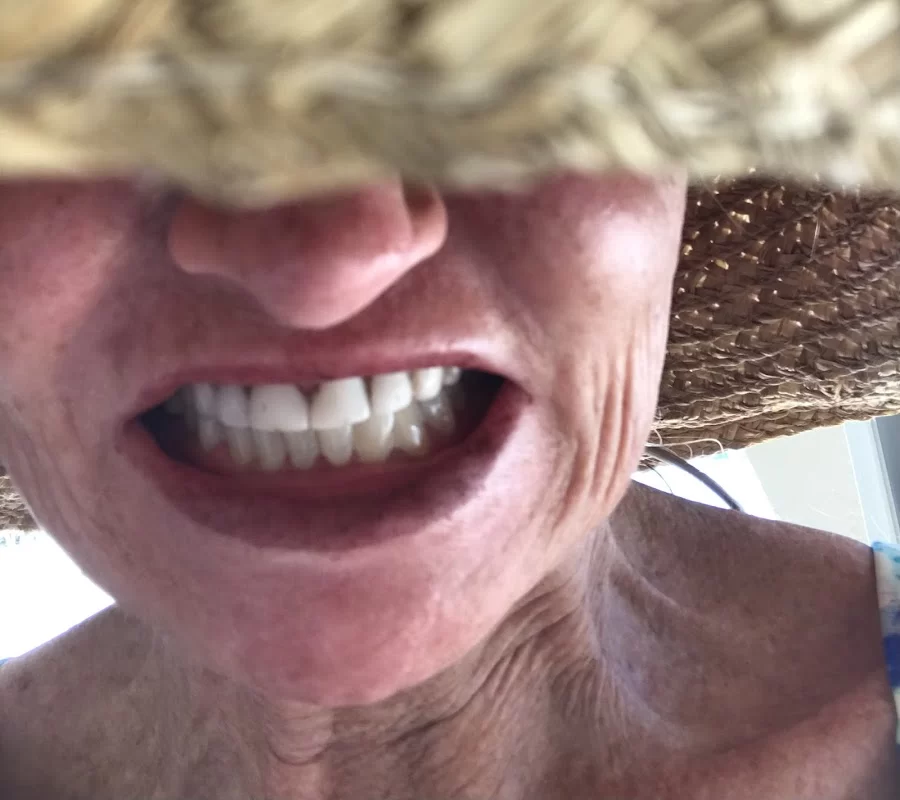 Six Mile Cypress Dental Care Picture 4