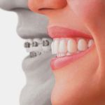 Forever Smile Dental Care
