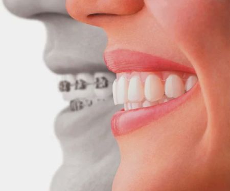 Forever Smile Dental Care