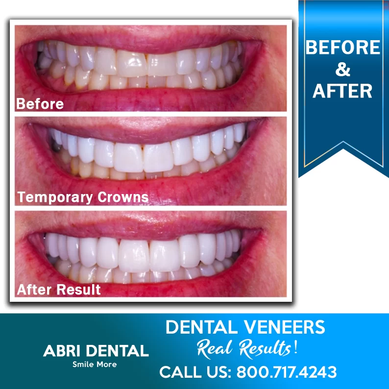 Abri Dental 10