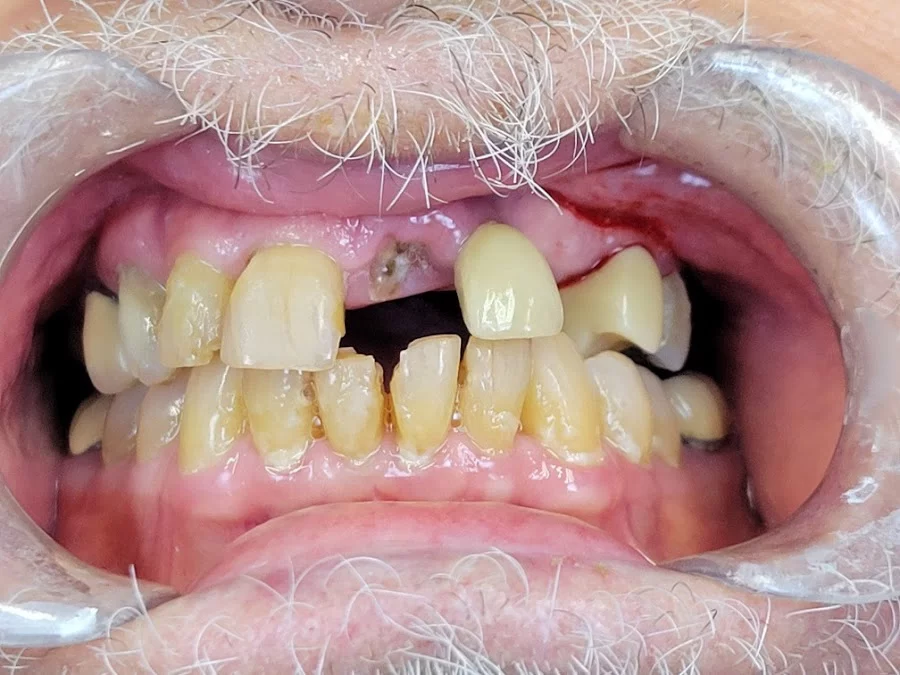 Smile Cape Coral 4