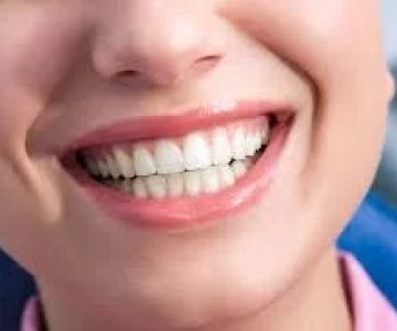 Transform Your Smile with Veneers: A Comprehensive Guide