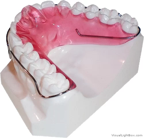 Precision Orthodontic Laboratory 1