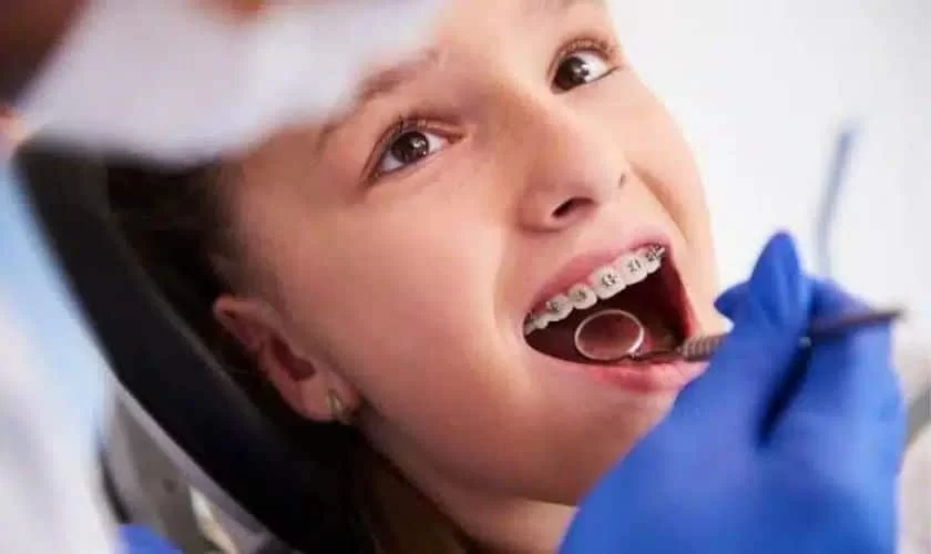 What Is the Best Age to Start Orthodontic Treatment for Bite Problems?