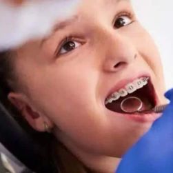 What Is the Best Age to Start Orthodontic Treatment for Bite Problems?