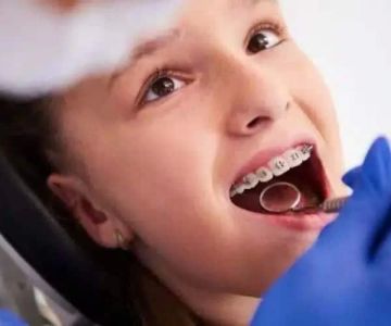 What Is the Best Age to Start Orthodontic Treatment for Bite Problems?