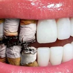 The Impact of Smoking on Oral Health and Ways to Prevent Damage