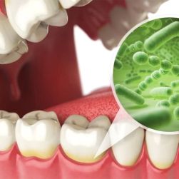 How to Manage the Impact of Oral Bacteria on Overall Health