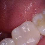 Sterling Smile Dental Care