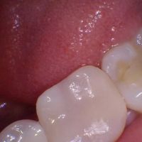 Sterling Smile Dental Care ico