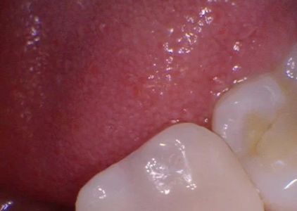 Sterling Smile Dental Care