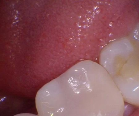 Sterling Smile Dental Care
