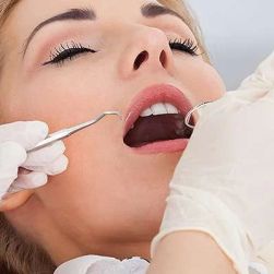 Best Dentist for Fillings and Cavity Prevention in Seattle: Your Guide to Healthy Teeth