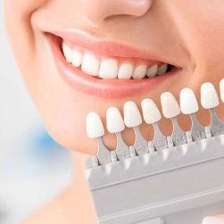 Best Cosmetic Dentist for Smile Makeover in San Francisco: Transform Your Smile Today