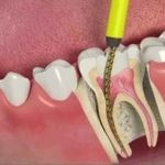 San Fernando & Pacoima Family Dental