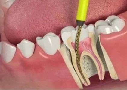 San Fernando & Pacoima Family Dental