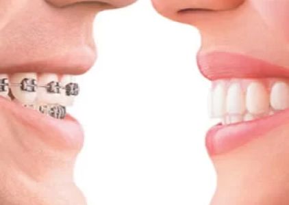 Happy Braces Orthodontics, La Mirada