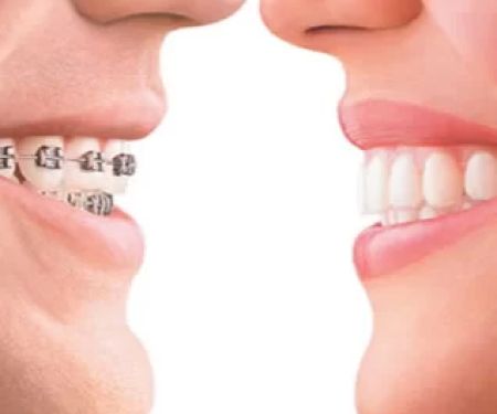 Happy Braces Orthodontics, La Mirada