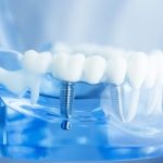 La Habra Advanced Dentistry